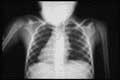 X-Rays