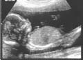 The First Stirrings of My Baby Within Me