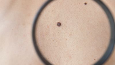 More Deadly than Cancer