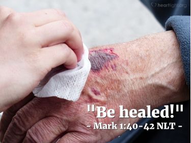 Illustration of the Bible Verse Mark 1:40-42 NLT