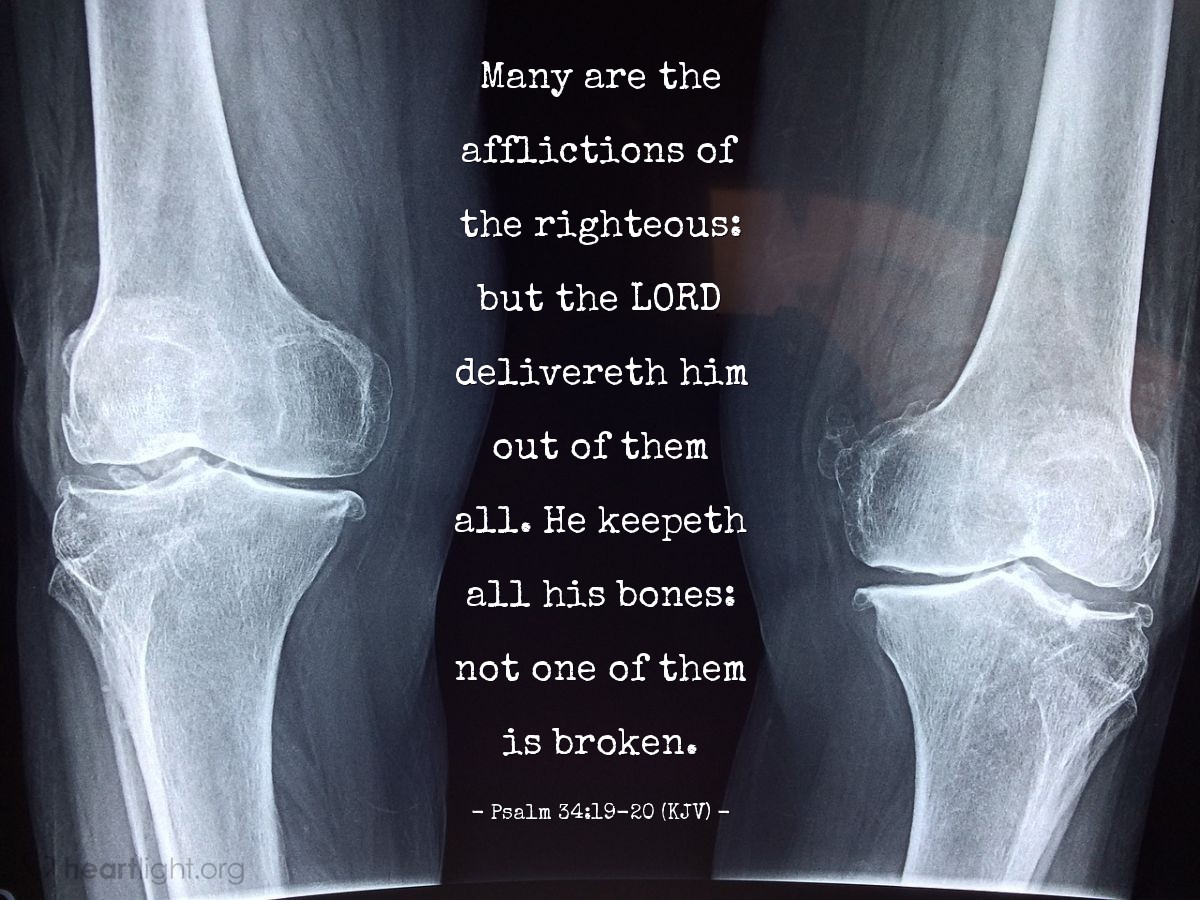 Illustration of Psalm 34:19-20 (KJV) — Many are the afflictions of the righteous: but the LORD delivereth him out of them all. He keepeth all his bones: not one of them is broken.