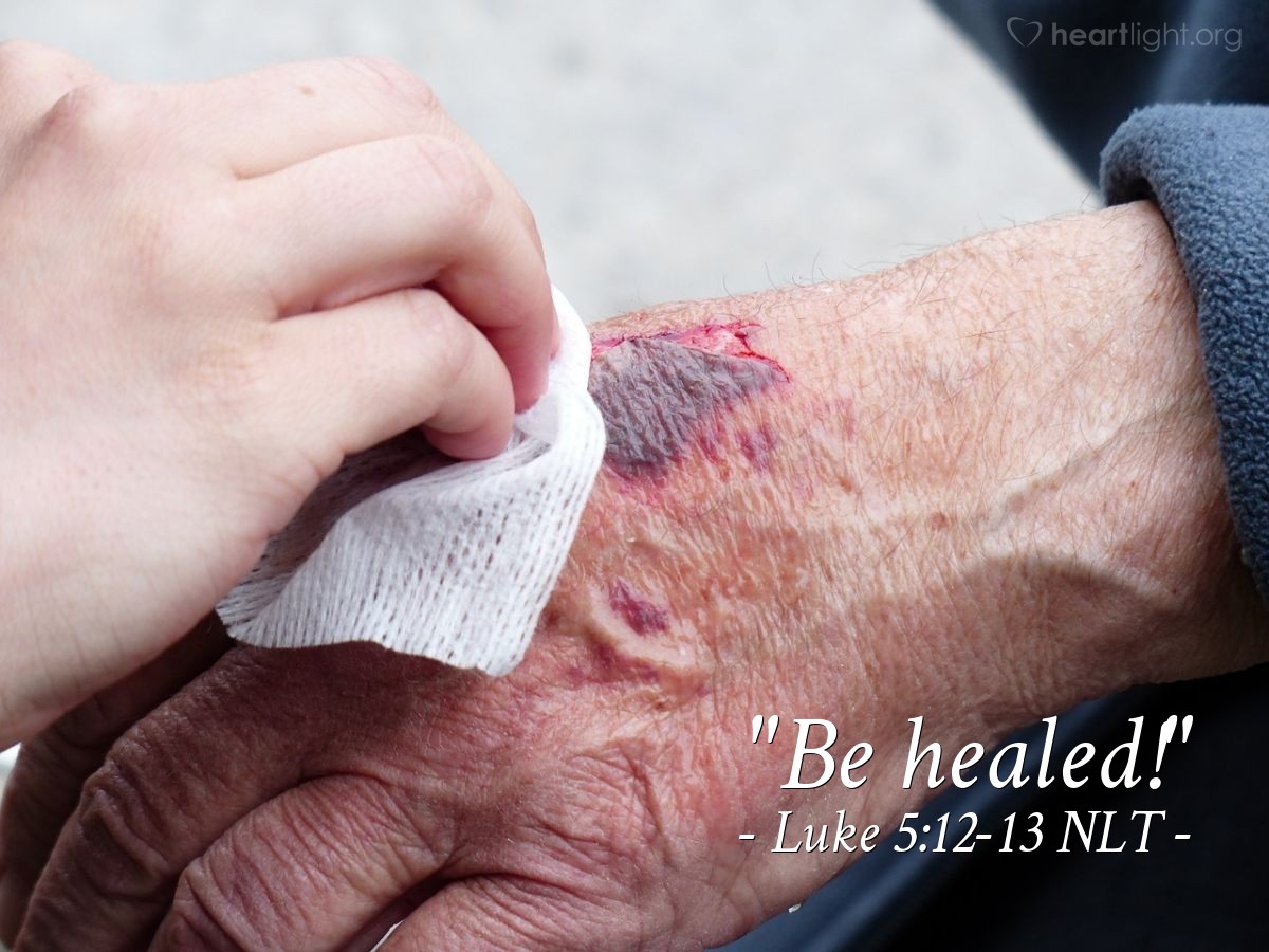 Illustration of Luke 5:12-13 NLT — "Be healed!"